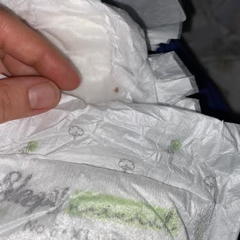 Bebek Bezlerinde Anlaşılmaz Böcek Sorunu