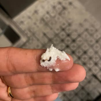 Yoğurttan Çıkan Gizemli Siyah Madde