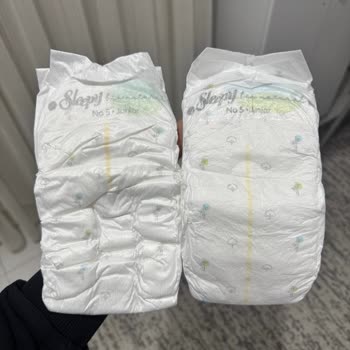 Hatalı Bebek Bezi İle Yaşanan Mağduriyet