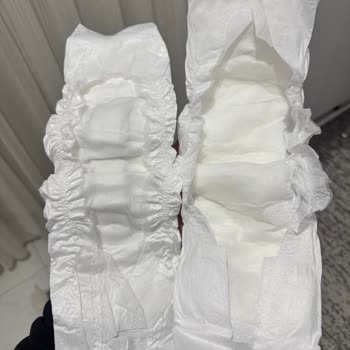 Hatalı Bebek Bezi İle Yaşanan Mağduriyet