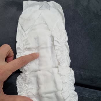 Sleepy Bebek Bezleri Pişik Ve Sızıntı Sorunları Yaratıyor