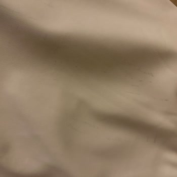 Stradivarius'tan Aldığım Etekte Beklenmedik Leke Sorunu