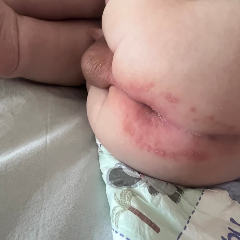 Mustela Pişik Kremi Hayal Kırıklığına Uğrattı