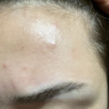 Cilt Ürünleri Cildimi Tahriş Etti