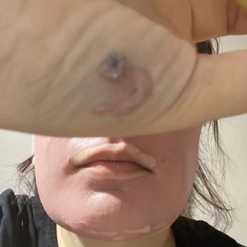 Dermokil Kil Maskesinde Şok Edici Plastik Parçası