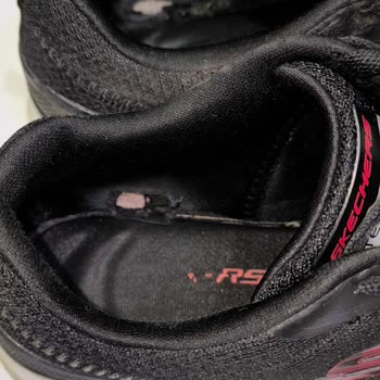 Skechers Ayakkabıda Hızlı Deformasyon Ve Yetersiz İnceleme