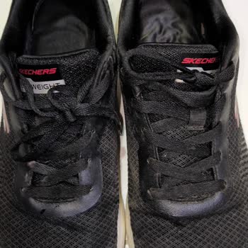Skechers Ayakkabıda Hızlı Deformasyon Ve Yetersiz İnceleme