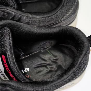 Skechers Ayakkabıda Hızlı Deformasyon Ve Yetersiz İnceleme