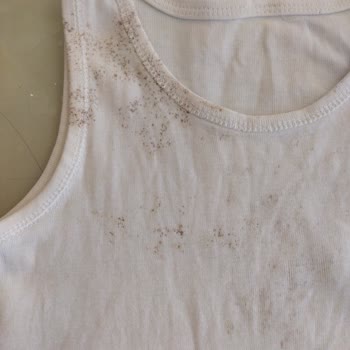 Bosch Çamaşır Makinesi: Leke Çıkarmayan Ve Sorunlu Hizmet