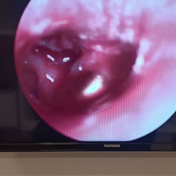 Hastanede Yanlış Müdahale: Çocuğumun Sağlığı Tehlikede