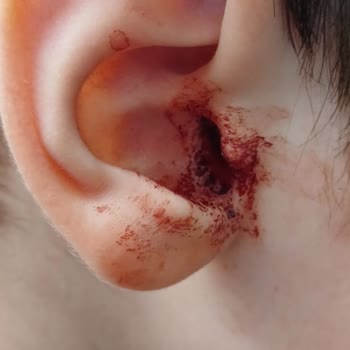 Hastanede Yanlış Müdahale: Çocuğumun Sağlığı Tehlikede