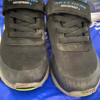 Skechers Çocuk Ayakkabılarının Kalitesizliği Ve Garanti Sorunu