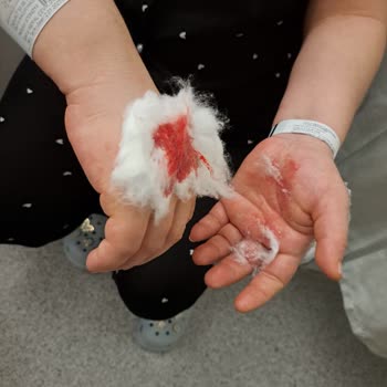 Tuzla Devlet Hastanesi'nde Yetersiz İlgi Ve Sert Davranışlar