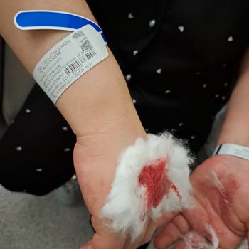 Tuzla Devlet Hastanesi'nde Yetersiz İlgi Ve Sert Davranışlar