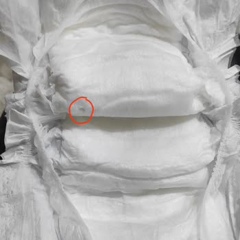 Sleepy Yenidoğan Paketinde Tehlikeli Cisim Şoku