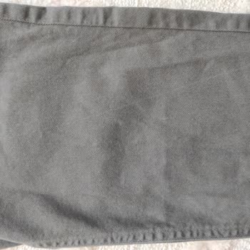 Pantolonlarda Çizgisel Renk Değişimi Ve Yetersiz İnceleme