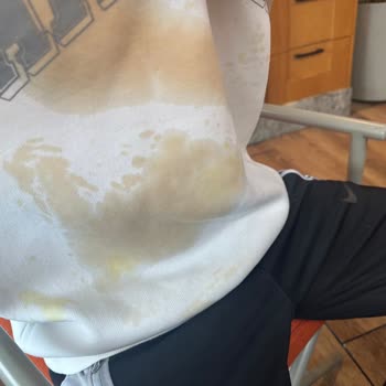 Portakal Suyu Ve Çay Kazası: Güvenlik Önlemleri Talebi