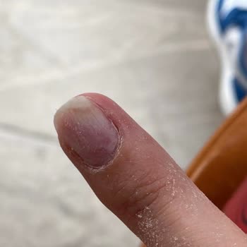 Zamanında Hizmet Ve Hijyen Eksikliği