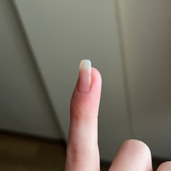 Zamanında Hizmet Ve Hijyen Eksikliği