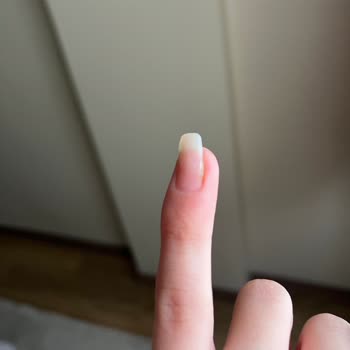 Zamanında Hizmet Ve Hijyen Eksikliği