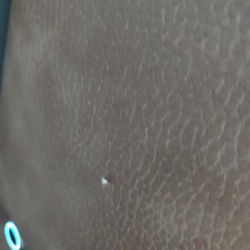 Bambi Baza Başlığındaki Sorunlar Çözülmüyor