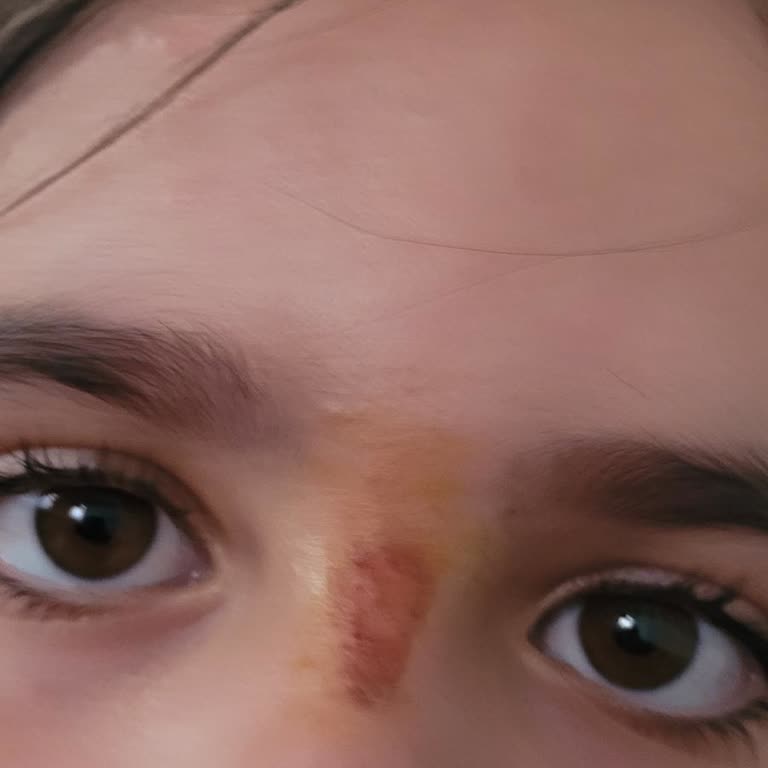 Dalin Köpük Sabun Cilt Sorunları Yarattı