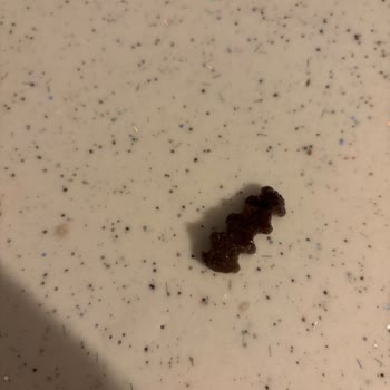 Harras Marka Fileden Çürük Parmak Patates Şikayeti