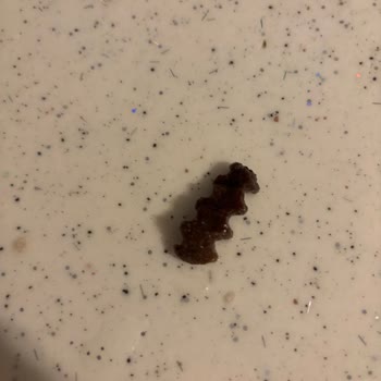 Harras Marka Fileden Çürük Parmak Patates Şikayeti