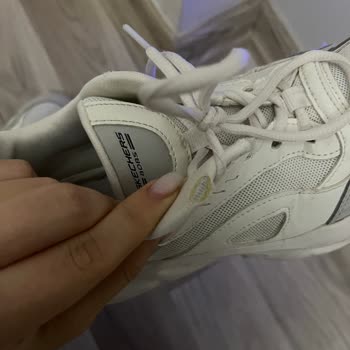 Skechers Ayakkabıda Hızla Oluşan Yırtık Ve Garanti Sorunu