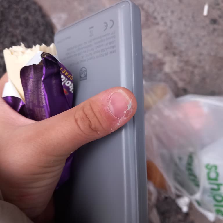 Gofretten Çıkan İstenmeyen Sürprizler