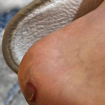 Elle Botlarda Kalitesiz Malzeme Ve Kötü Müşteri Hizmeti