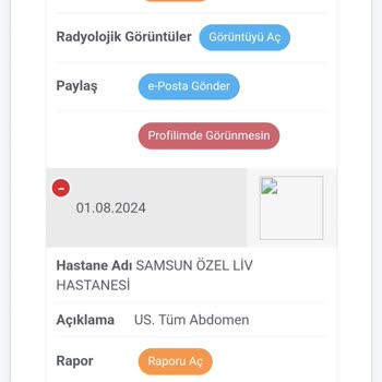 Yanlış Faturalandırma Ve Sigorta Mağduriyeti