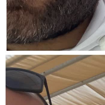 Lazer Ameliyatı Sonrası Mağduriyet Ve İlgisizlik