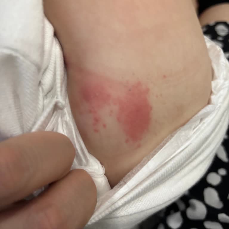 Bebek Bezi Alerjisi: Güvenilir Marka Sorgulanıyor