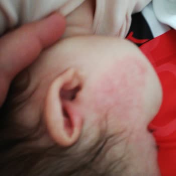 Dalin Avokadolu Şampuan Bebeklerde Cilt Sorunlarına Yol Açıyor