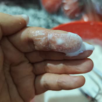 Krem Şanti Ürününün Hijyen Sorunu