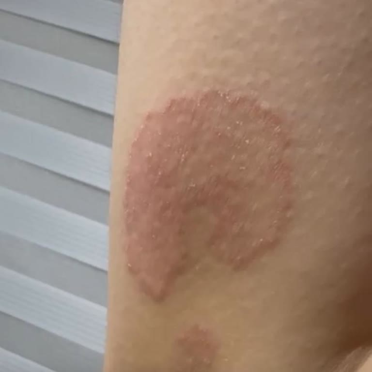 Dermatoloji Randevu Sistemindeki Sürekli Sorunlar