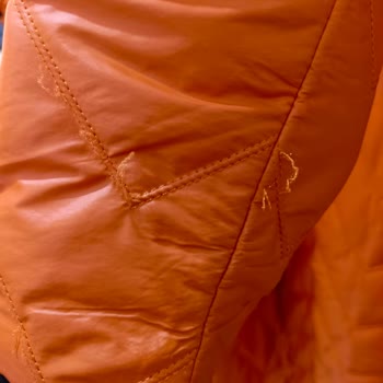 Montun Dikişleri İki Haftada Atmaya Başladı, İade Talebim Reddedildi