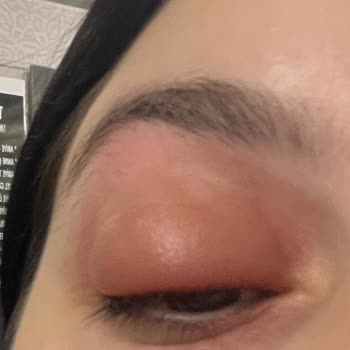 Skin Sensual Göz Serumuyla Gelen Beklenmedik Alerjik Reaksiyon