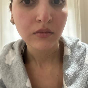 Cilt Yanığına Sebep Olan Temizleyici