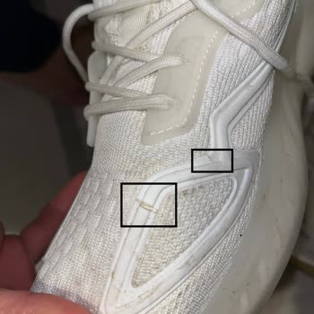 Değişim Sonrası Yine Deforme Olan Ayakkabı Ve İlgisizlik