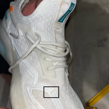 Değişim Sonrası Yine Deforme Olan Ayakkabı Ve İlgisizlik