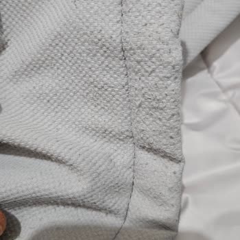 Ürünün Tüylenmesi Ve Mağaza Desteği Eksikliği