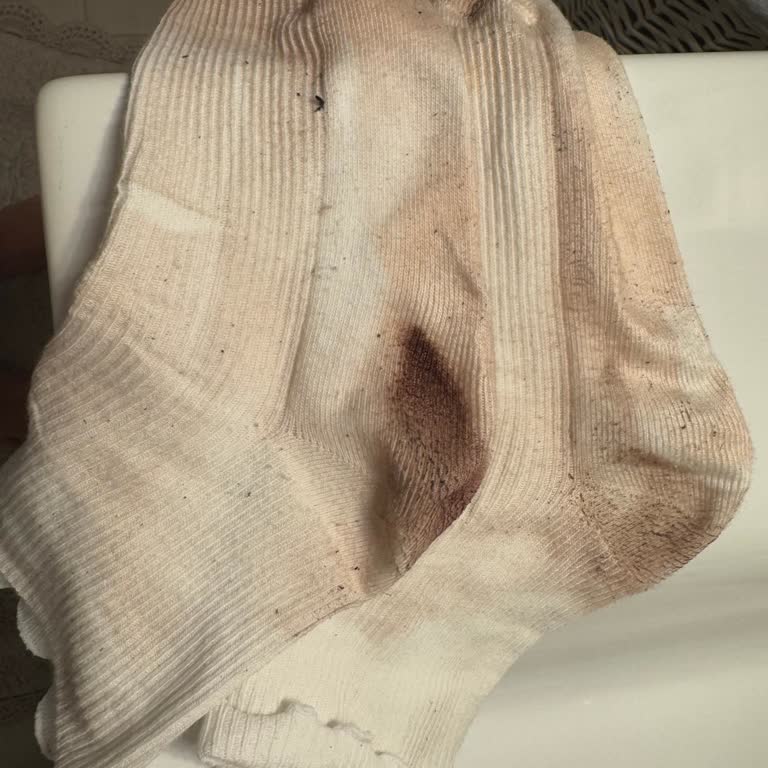 Boyanan Çoraplar Ve İade Sorunu