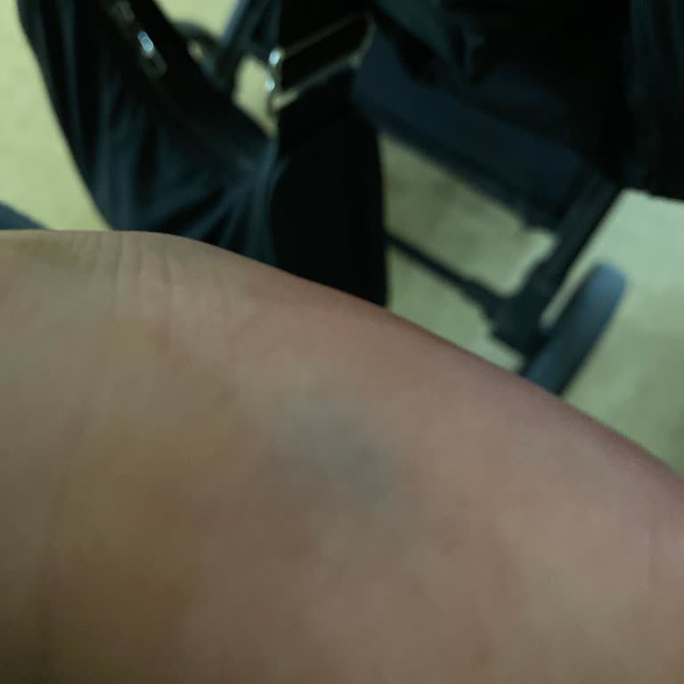 Acil Serviste Bebeklere Yetersiz Hizmet Ve İlgisizlik