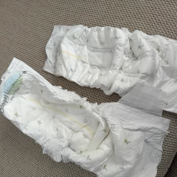 Sleepy Bebek Bezi Kalitesinde Ani Düşüş Ve Pişik Sorunu