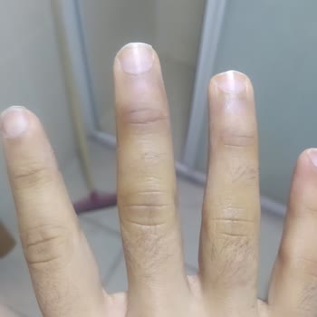 Randevu Cezası Sağlık Durumumu Tehlikeye Atıyor