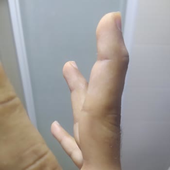 Randevu Cezası Sağlık Durumumu Tehlikeye Atıyor