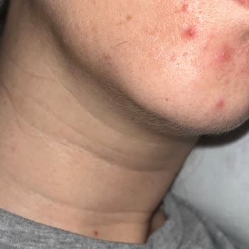 Beklenmedik Cilt Problemleriyle Karşılaştım