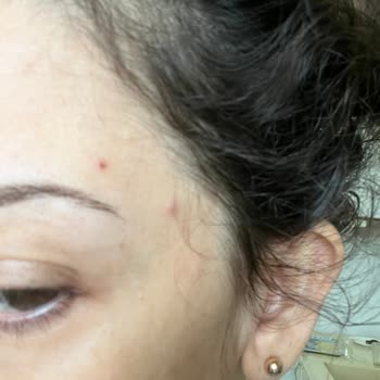 Beklenmedik Cilt Problemleriyle Karşılaştım